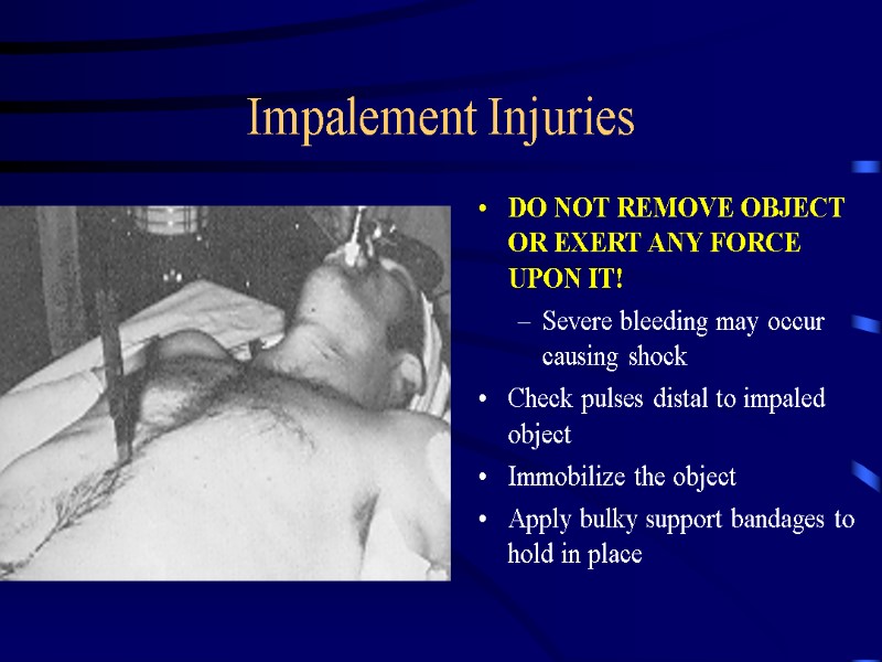 Impalement Injuries DO NOT REMOVE OBJECT OR EXERT ANY FORCE UPON IT! Severe bleeding